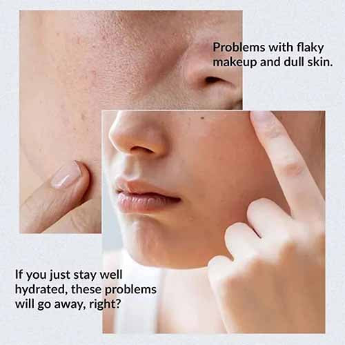 Anua Birch 70% Moisture Boosting Serum - 30ml
