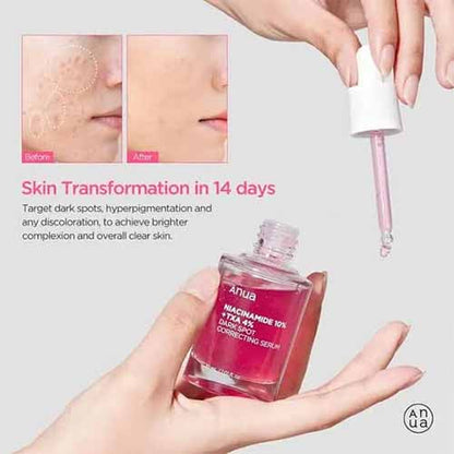 Anua Niacinamide 10% + TXA 4% Dark Spot Correcting Serum - 30ml