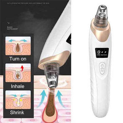 Pro-Grade Pore Vacuum Cleaner |Blackhead Remover | Deep Cleanse, Radiant Skin