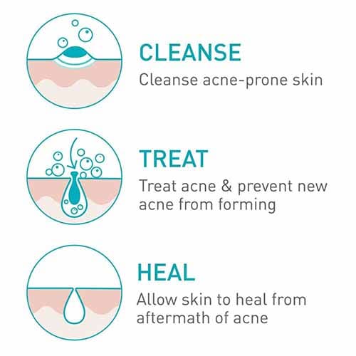 CeraVe Acne Foaming Cream Cleanser – 150ml