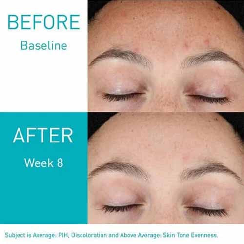 CeraVe Resurfacing Retinol Serum (1 oz)